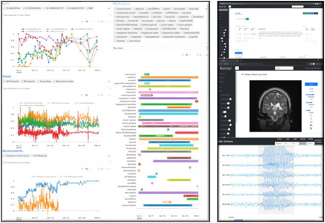 Neuro ICU dashboard