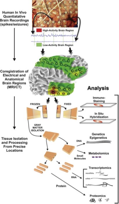 Epilepsy tissue processing